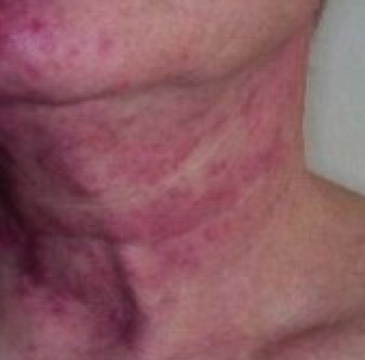 Before/After Image